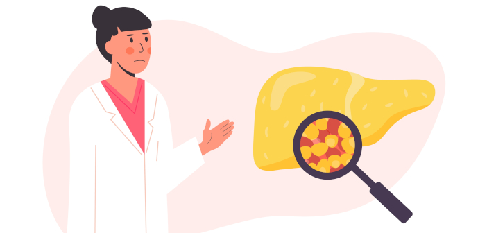 How Much Weight to Lose to Reverse Fatty Liver